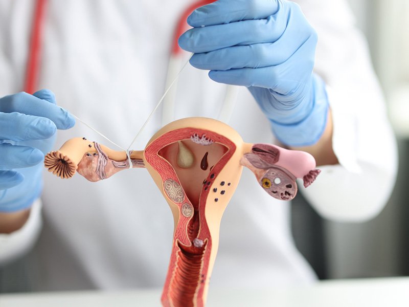 PCOD and PCOS Management at Healing Sparshh UroGynae Clinic