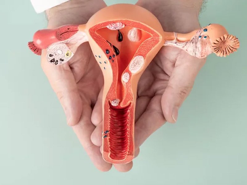 Vaginal Infection Treatment